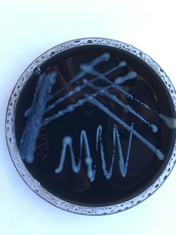 Gewachsene Legionellenkolonien auf einer Agarplatte im Labor.