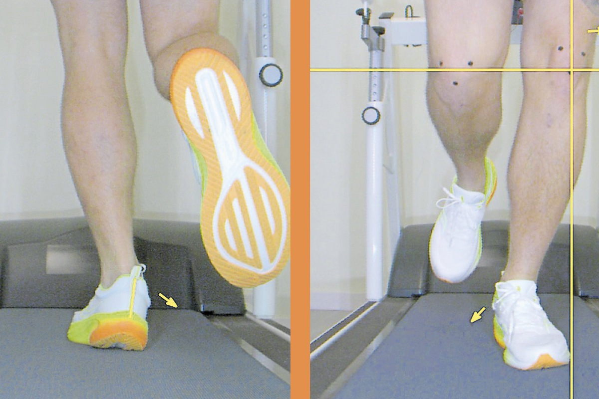 Links: Beurteilung der Stabilität von Sportschuhen. Rechts: Stellung des Knies von vorne beim Joggen.